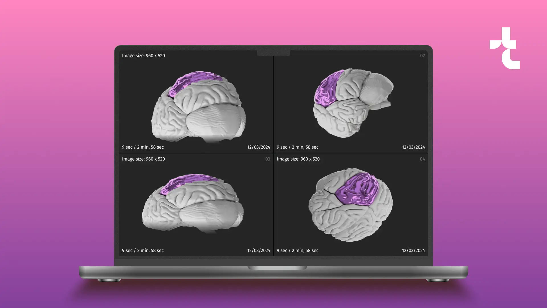 Enhancing Healthcare with 3D Medical Imaging Integration